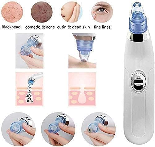 BELOXY 4 In 1 Multi-Function Blackhead Whitehead Extractor Remover Device Facial Cleansing Tool,Skin Cleaner,Pimple Removal Tool,Acne Pimple Pore Cleaner Vacuum Suction Tool For Men & Women (White)