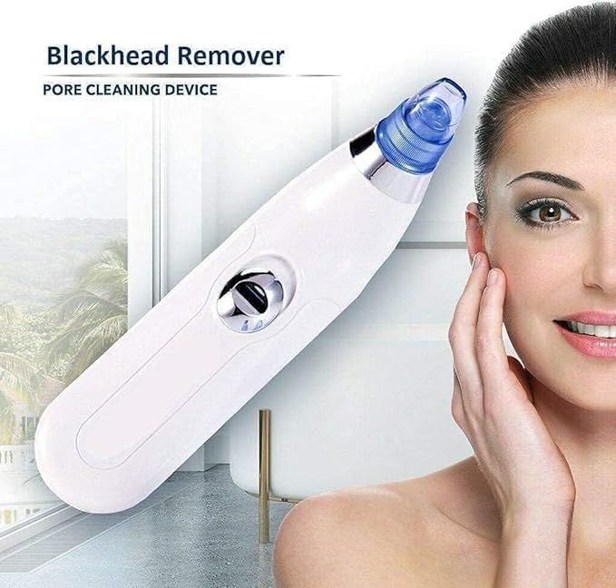 BELOXY 4 In 1 Multi-Function Blackhead Whitehead Extractor Remover Device Facial Cleansing Tool,Skin Cleaner,Pimple Removal Tool,Acne Pimple Pore Cleaner Vacuum Suction Tool For Men & Women (White)