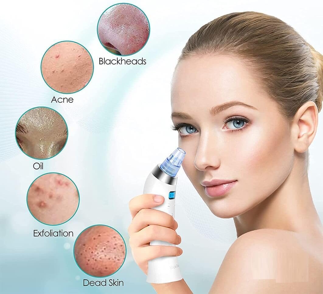 BELOXY 4 In 1 Multi-Function Blackhead Whitehead Extractor Remover Device Facial Cleansing Tool,Skin Cleaner,Pimple Removal Tool,Acne Pimple Pore Cleaner Vacuum Suction Tool For Men & Women (White)